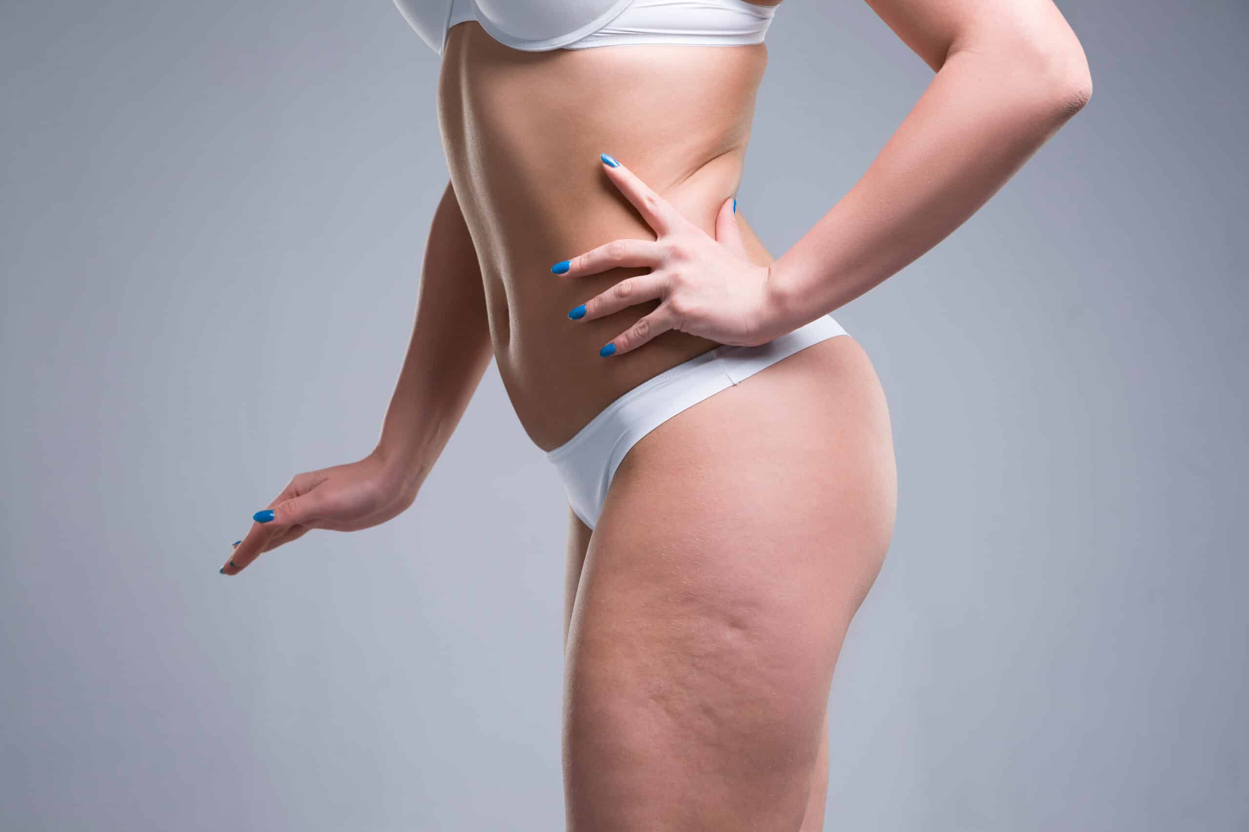 A model with blue nails standing in underwear in order to showcase subtle appearences of cellulite on her thighs.